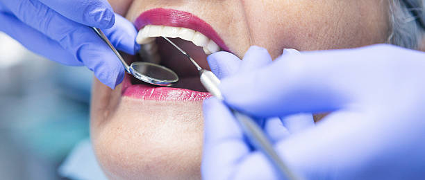 Best Emergency Treatment for Toothache in Sparta, GA
